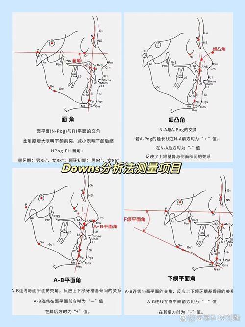 正畸测量中,每个角度的具体含义是什么?-图3 正畸测量中,每个角度的具体含义是什么?-图3