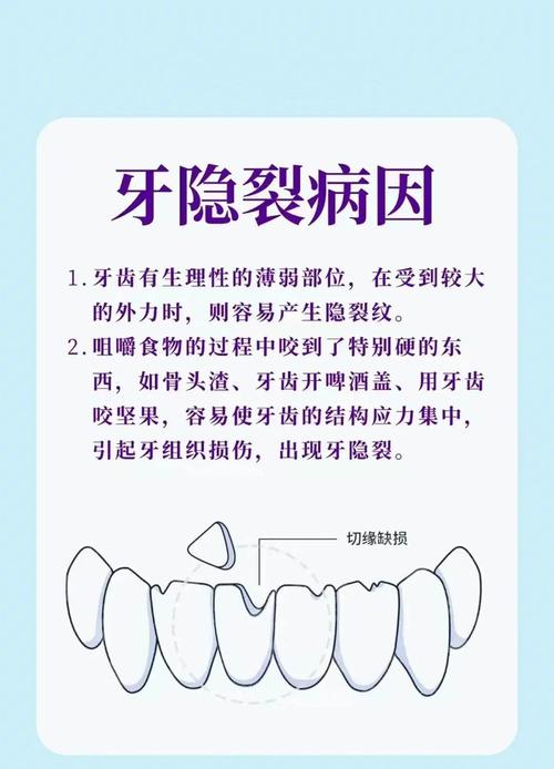 牙裂最佳治疗方法是什么？如何有效修复？-图3