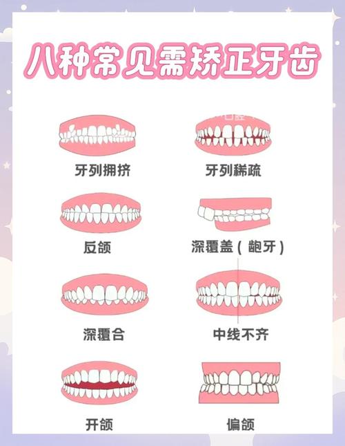 哪些人群不宜进行种植牙？这些禁忌需了解-图3