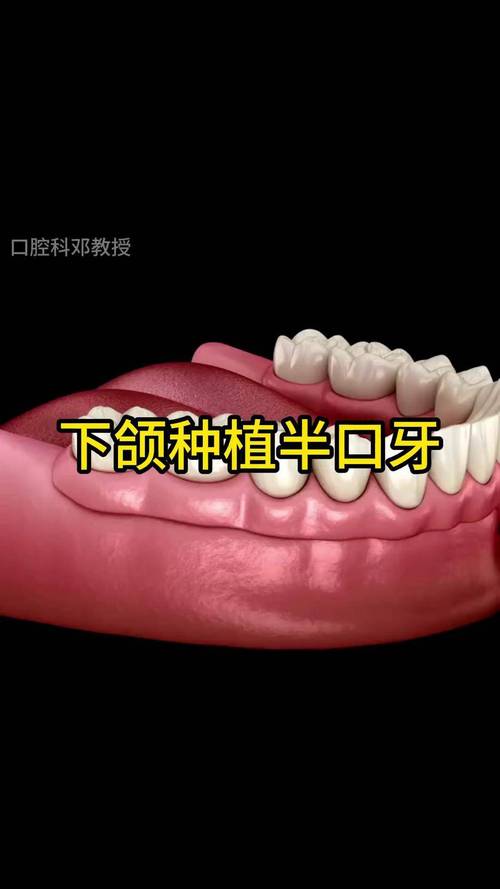 假牙可以新种牙吗-图1