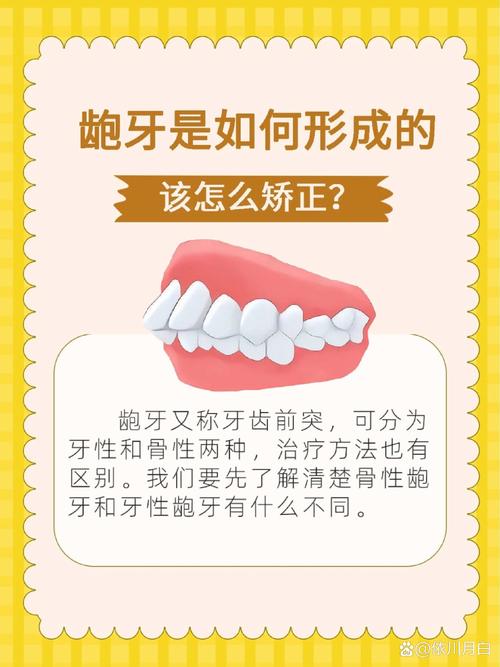 龅牙矫正有最快方法吗？哪种见效最迅速？-图1