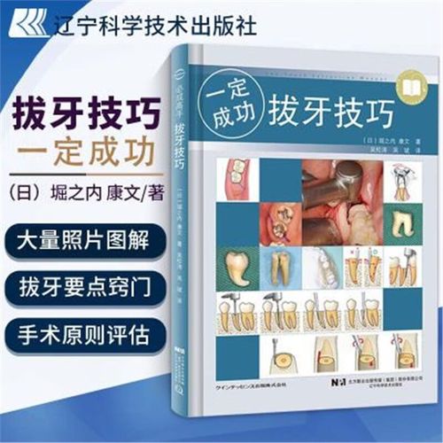 口腔拔牙基本方法有哪些关键步骤？-图2