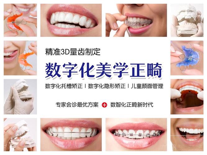 隐形正畸怎么选?品牌、效果还是适合更重要?-图1 隐形正畸怎么选?品牌、效果还是适合更重要?-图1