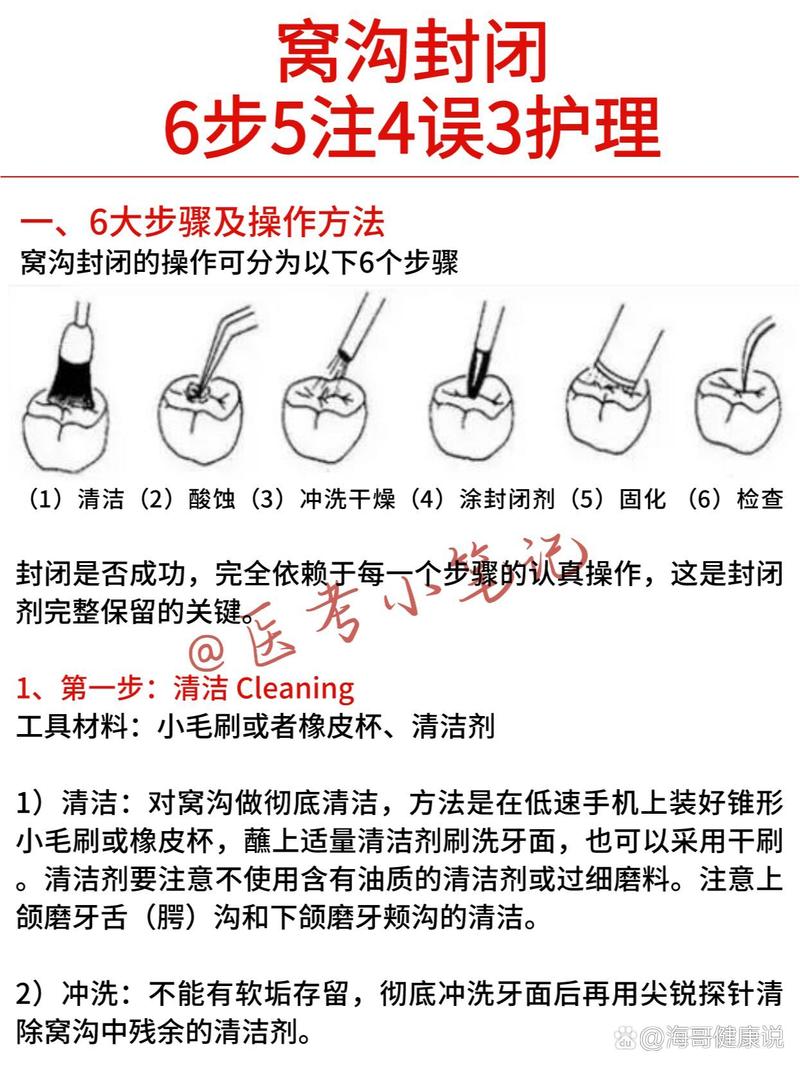 口腔封闭治疗方法有哪些主要类型？-图1