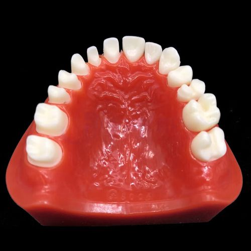 烤瓷牙的制作方法具体包含哪些步骤和材料？-图3