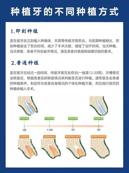 即刻种牙过程图解，当天种牙的步骤是怎样的？-图2