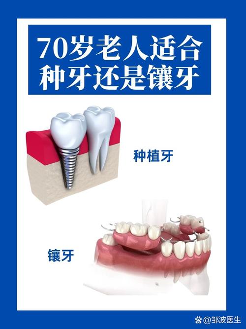 50多岁种牙合适吗？高龄种牙有哪些注意事项？-图2