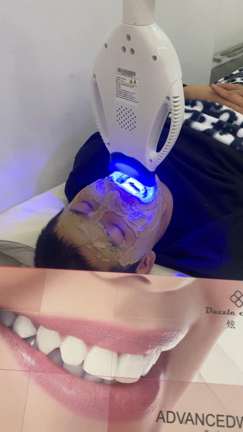 冷光美白操作方法的具体步骤有哪些详细说明？-图2