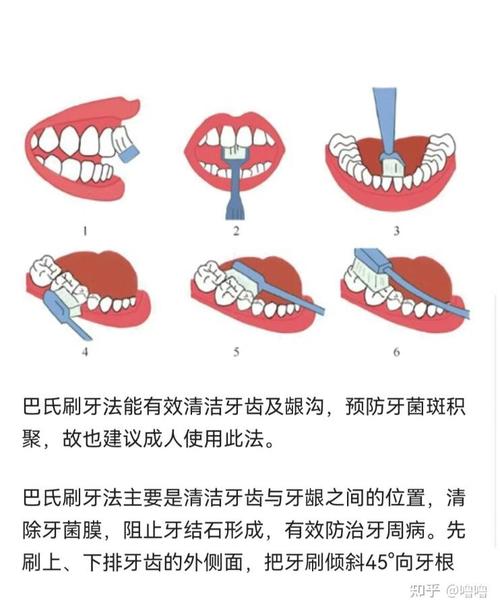 正畸期间刷牙，如何避免损伤牙套又清洁到位？-图1