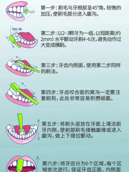 洗牙都有哪些方法？常见洗牙方式有几种？-图1