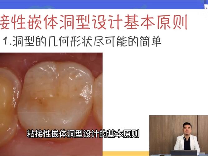 后牙牙体制备常用方法及其操作要点是什么？-图2