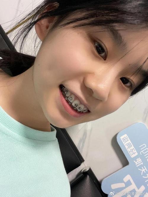 南京牙齿矫正正畸如何选择不踩坑的靠谱医院和医生呢？-图2