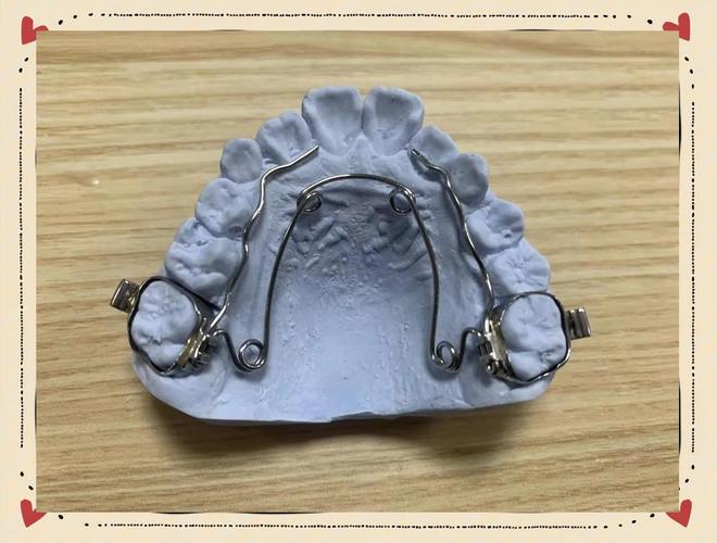 正畸nice弓是什么-图2