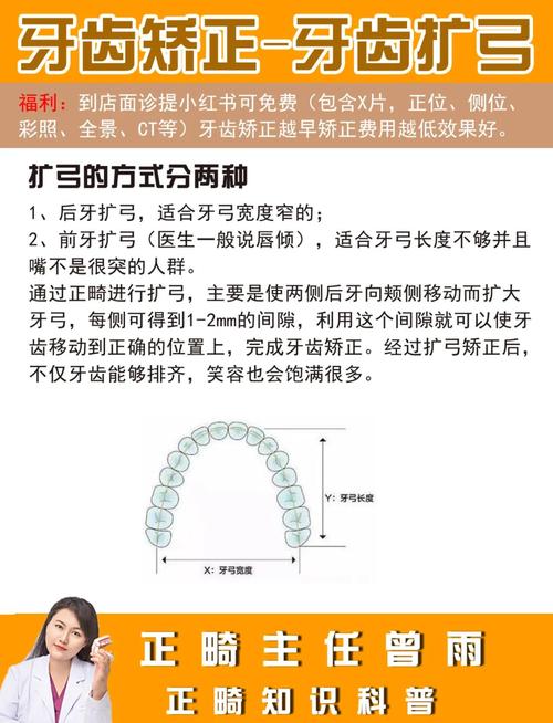如何判断正畸医生技术是否专业可靠?-图3 如何判断正畸医生技术是否专业可靠?-图3