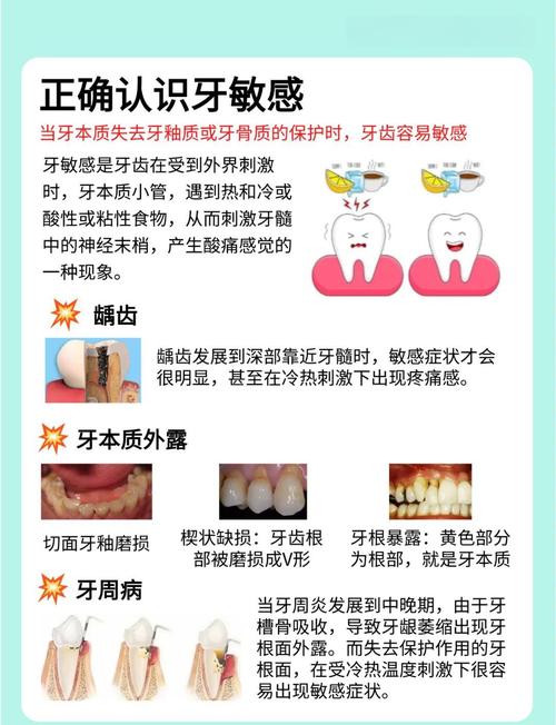 牙脱敏症状如何缓解？有哪些处理方法？-图2