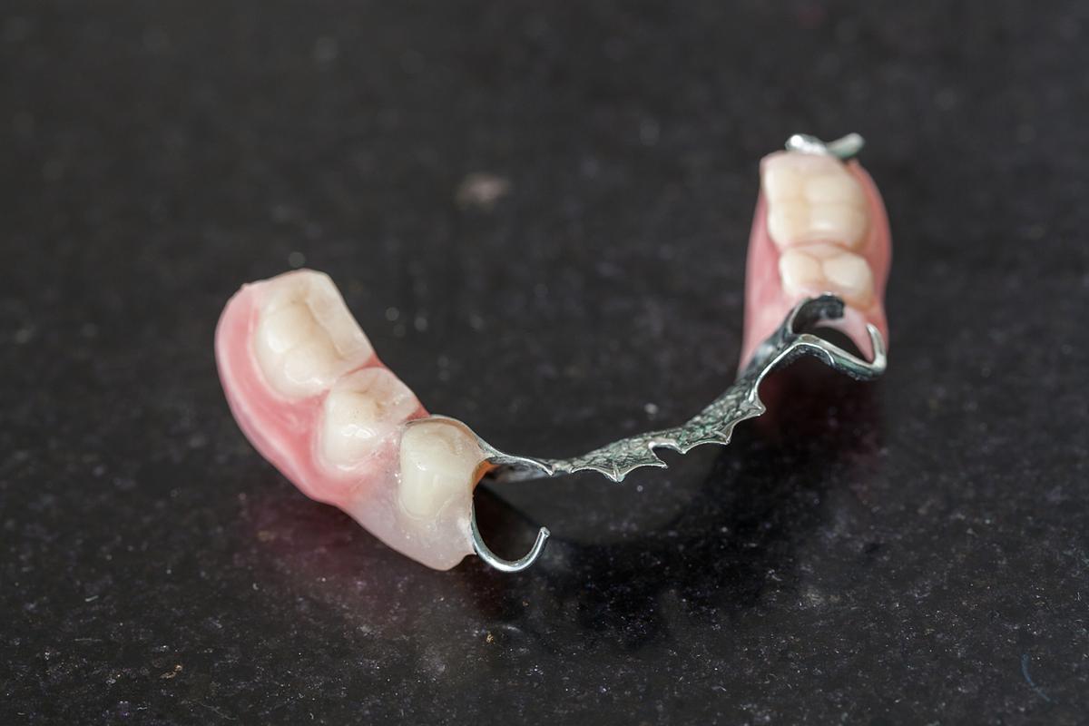 正畸种牙双料活动是什么?优惠如何参与?-图2 正畸种牙双料活动是什么?优惠如何参与?-图2