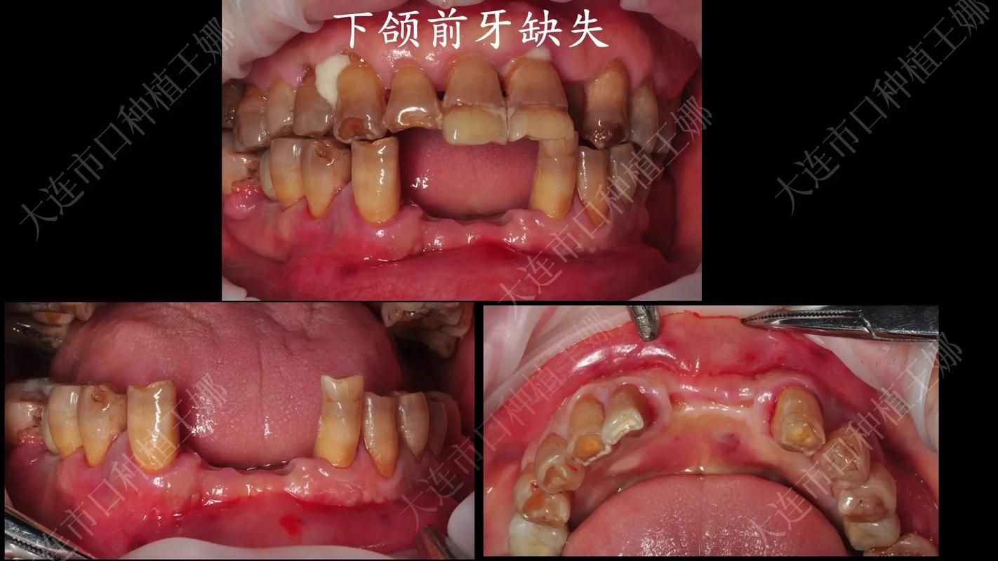 延吉友谊口腔种牙怎么样？价格和效果靠谱吗？-图2