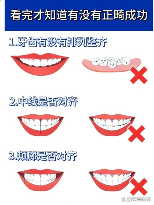正畸咬合关系分类图片如何区分不同类型？-图1