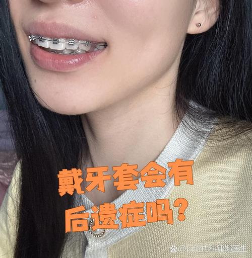 不带牙套整牙方法-图1