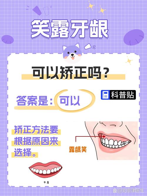 不带牙套整牙方法-图3