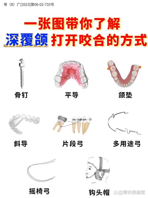 深覆合治疗方法有哪些？如何选择合适方案？-图2