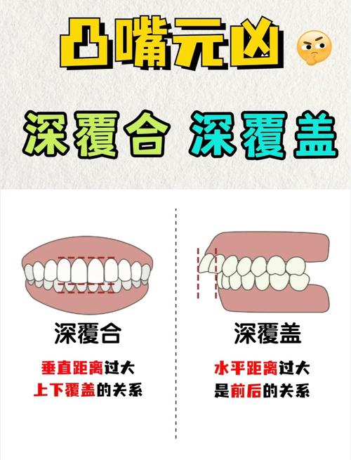 深覆合治疗方法有哪些？如何选择合适方案？-图3