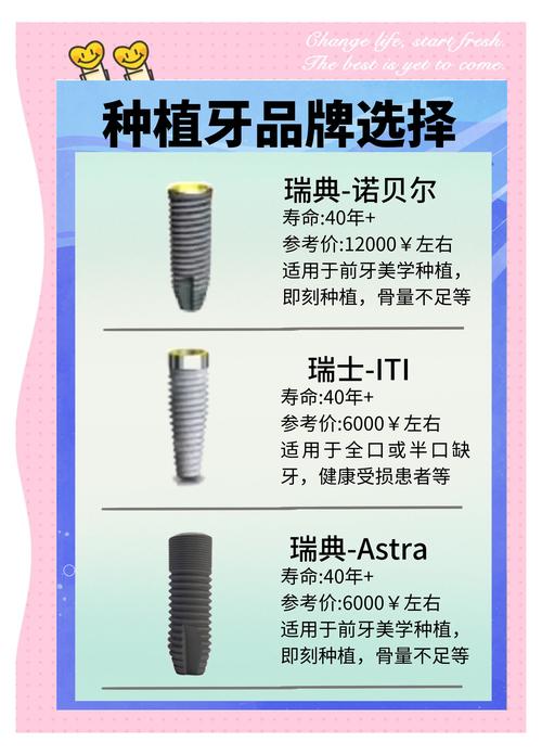 国产种牙品牌这么多，如何选到靠谱又合适的？-图2