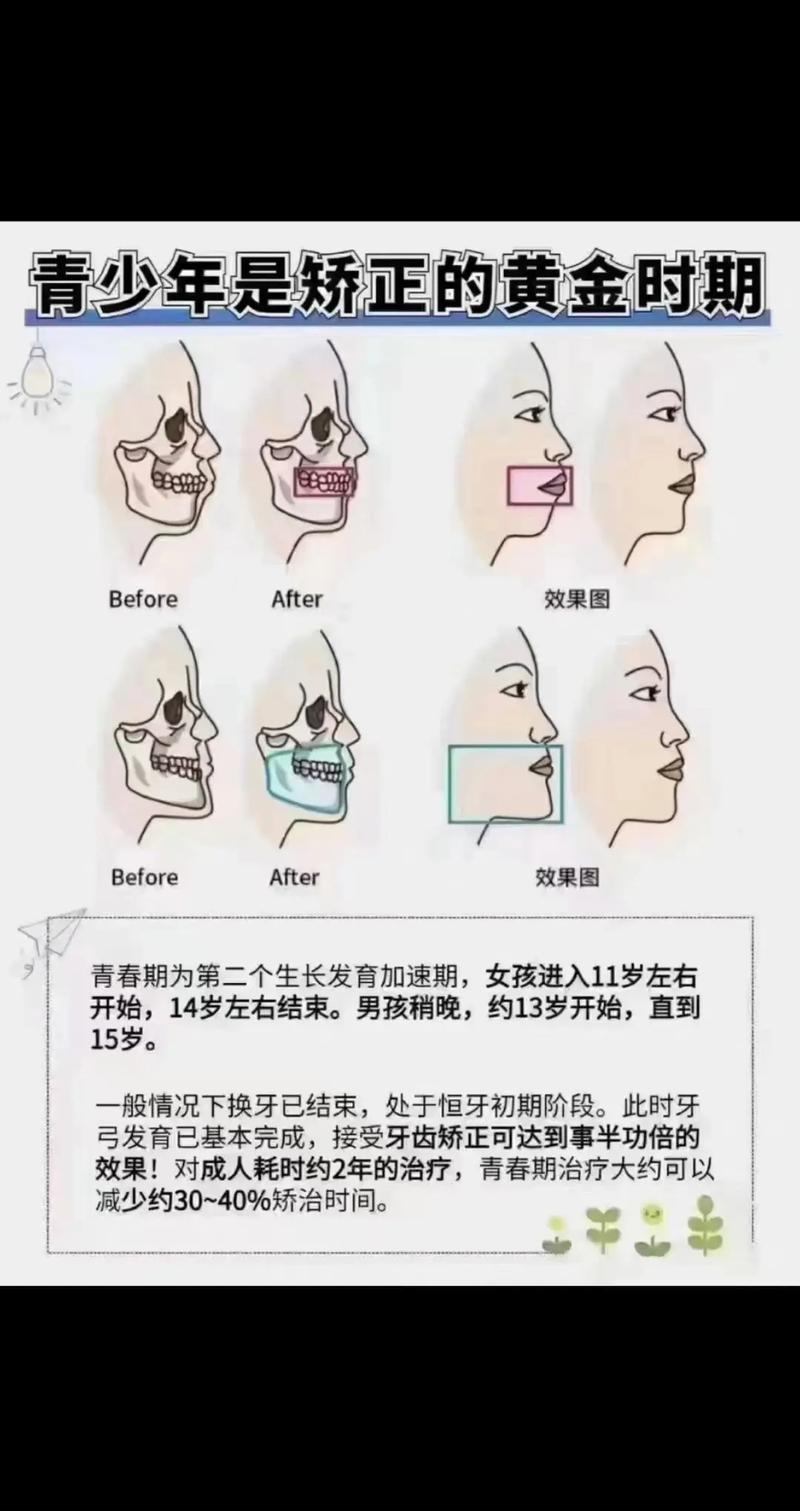 小孩反颌有哪些常用治疗方法?-图2 小孩反颌有哪些常用治疗方法?-图2