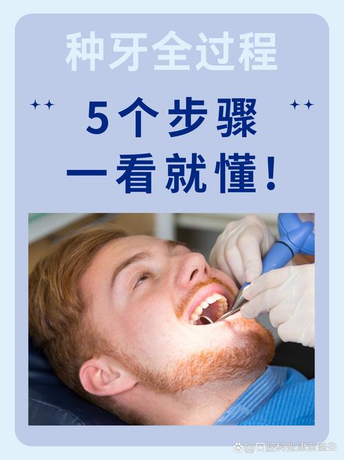 种牙使用韩国系统-图2