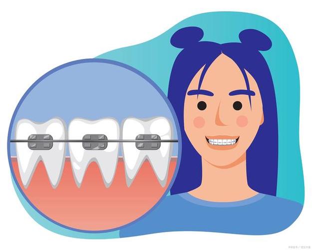 正畸模型分析动画制作如何提升诊疗效率？-图1