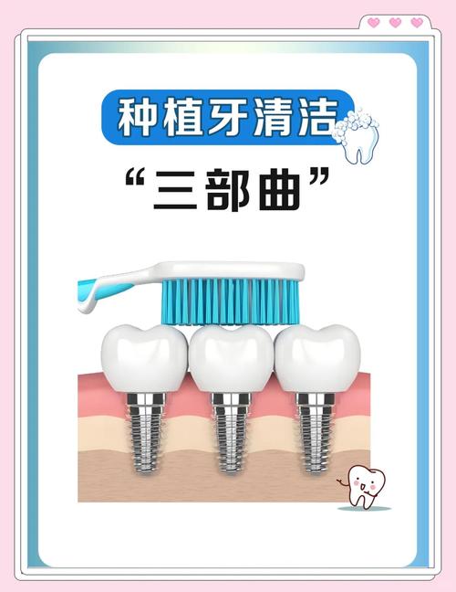 种植牙后日常清洁该如何做？维护健康的关键步骤-图2