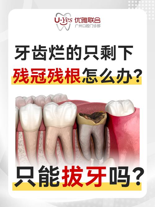 牙外伤的治疗方法有哪些？如何正确选择？-图2