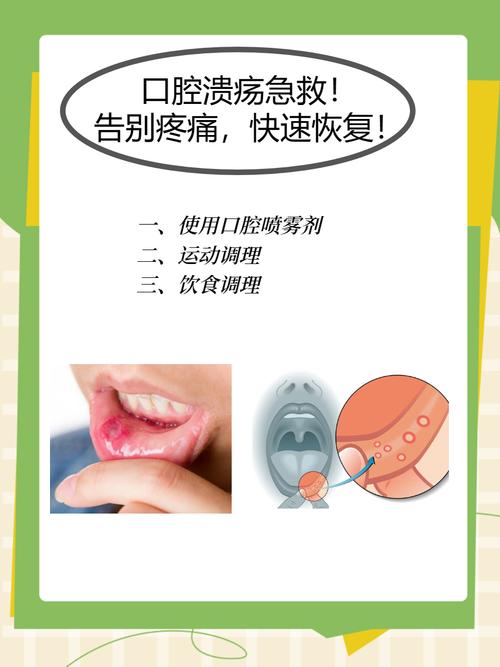 口腔溃疡快速治疗方法有哪些？-图3