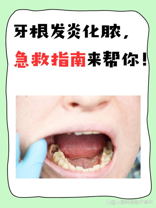 牙发炎治疗方法有哪些？实用方法速查-图3