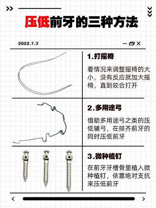 压低下前牙的有效方法有哪些?如何正确操作?-图1 压低下前牙的有效方法有哪些?如何正确操作?-图1