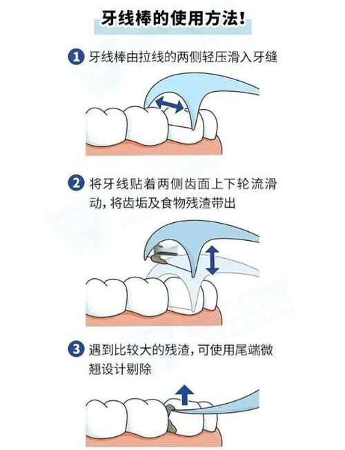 排龈线使用方法有哪些关键步骤?-图1 排龈线使用方法有哪些关键步骤?-图1