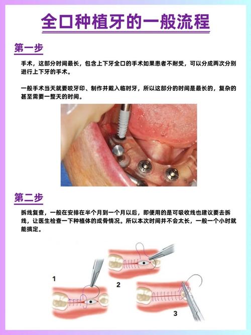 蓝天口腔种牙到底怎样?效果和体验如何?-图2 蓝天口腔种牙到底怎样?效果和体验如何?-图2