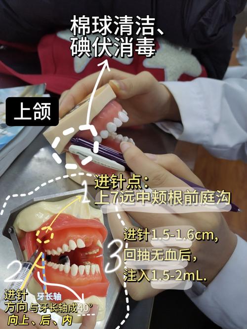 口腔局部麻醉常用方法有哪些？各有何优缺点？-图2