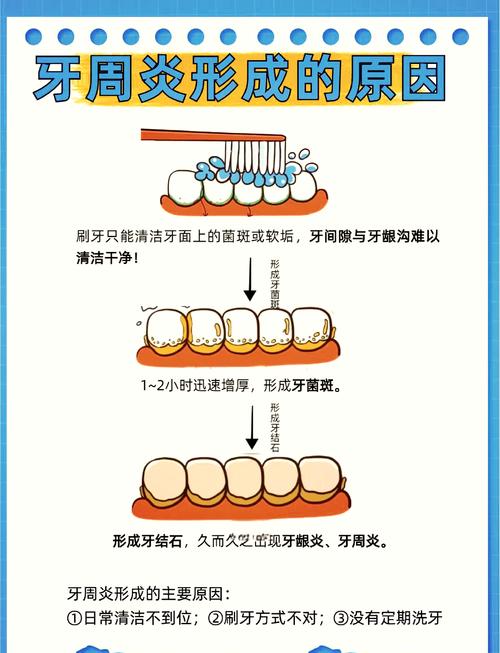 牙周炎治疗方法有哪些？科学选择需注意什么？-图2