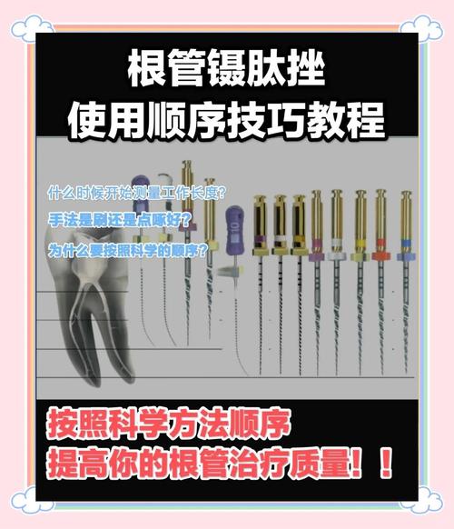 根管扩挫的具体操作方法有哪些关键步骤?-图2 根管扩挫的具体操作方法有哪些关键步骤?-图2