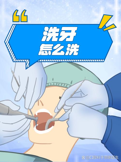 医院洗牙有哪些方法？哪种更适合自己？-图2