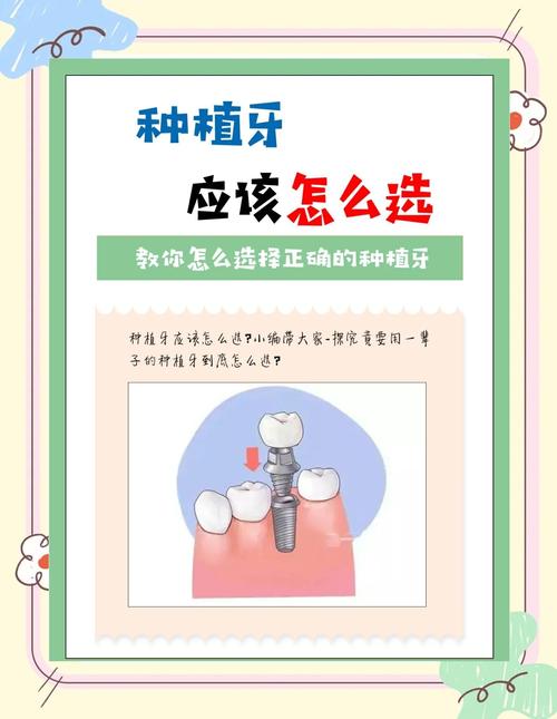 佛山种牙哪里价格更实惠？-图3