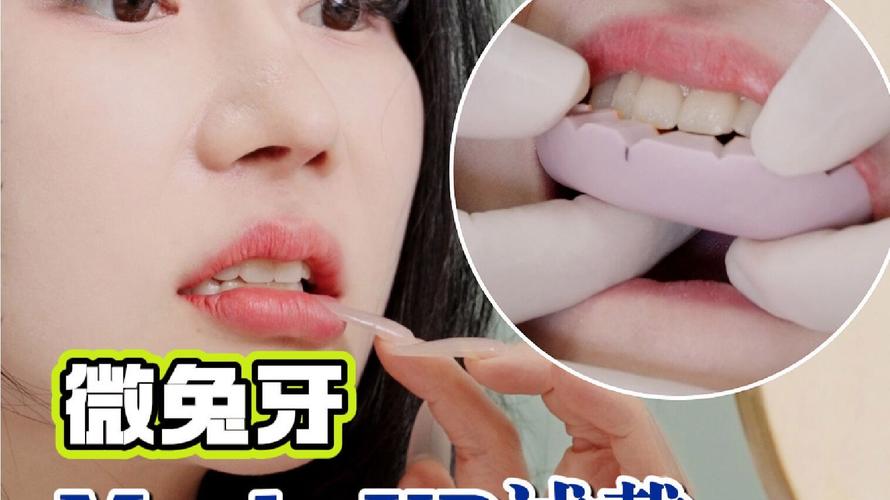 全口牙咬蜡方法的具体操作步骤有哪些？-图3