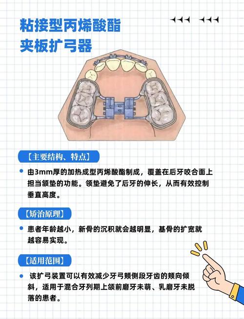 正畸扩牙弓调整磨牙能改善哪些咬合问题？-图1