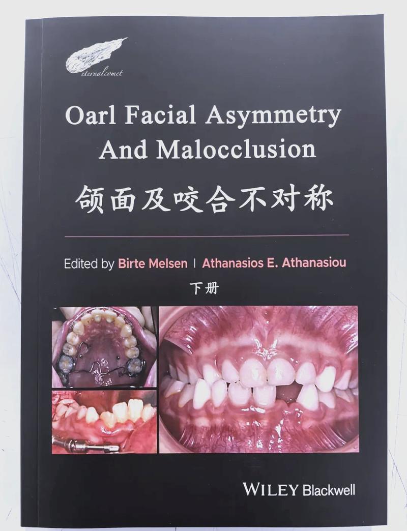 美学正畸关节联合论坛，如何实现功能与美学协同？-图3