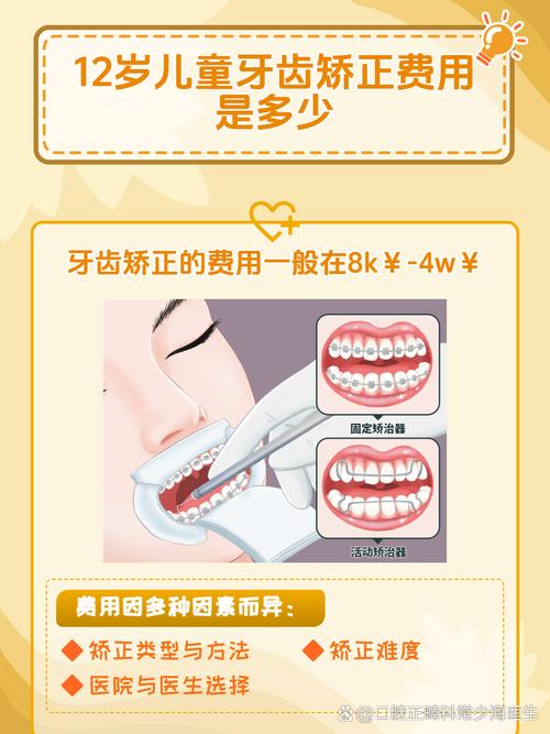 广州牙齿正畸费用多少？不同情况价格差异大吗？-图3