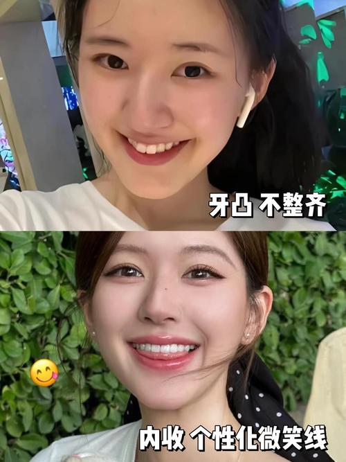 明星种牙视频合集，效果真如传言那么好？-图1