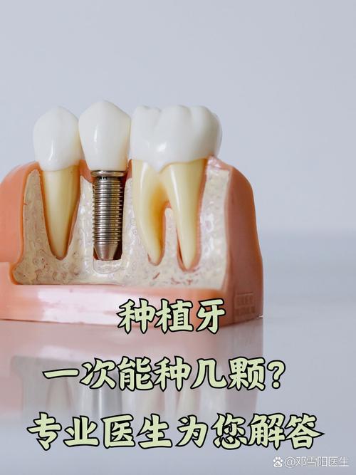 温州种牙哪里靠谱？好医院医生怎么选？-图3