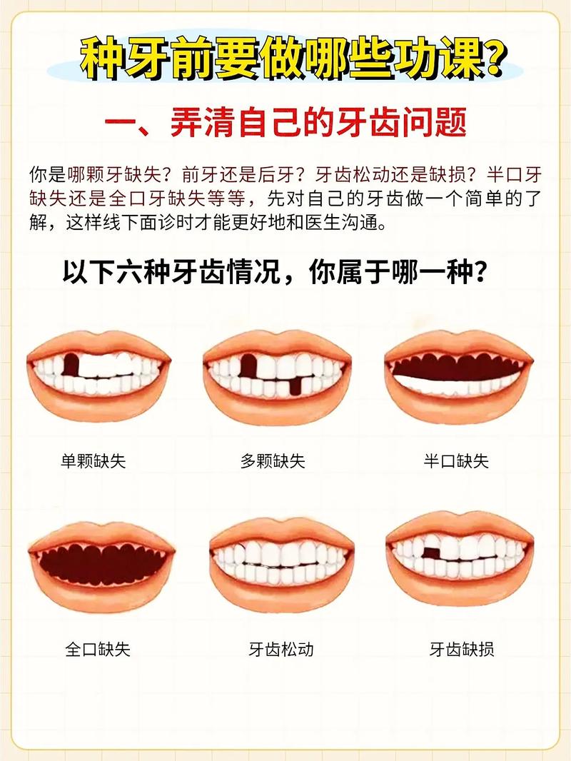 种牙后需警惕哪些症状？-图2