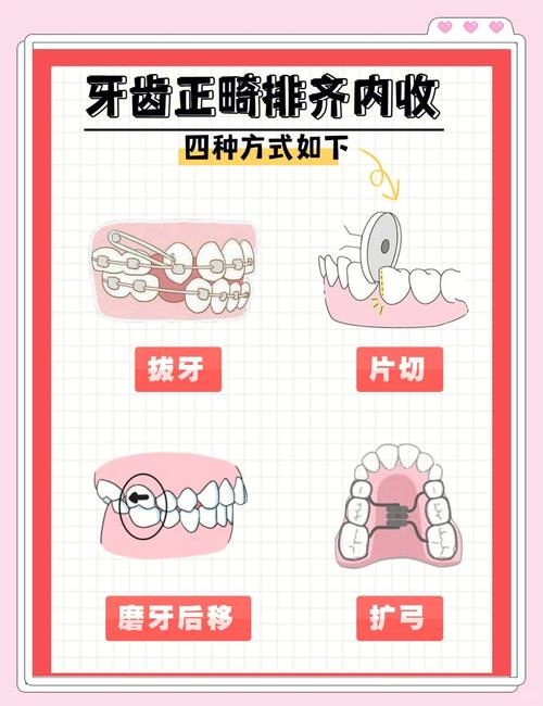 孩子牙齿不齐?小牙纠正方法有哪些?-图3 孩子牙齿不齐?小牙纠正方法有哪些?-图3